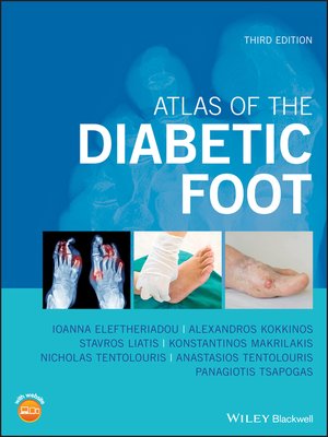 cover image of Atlas of the Diabetic Foot